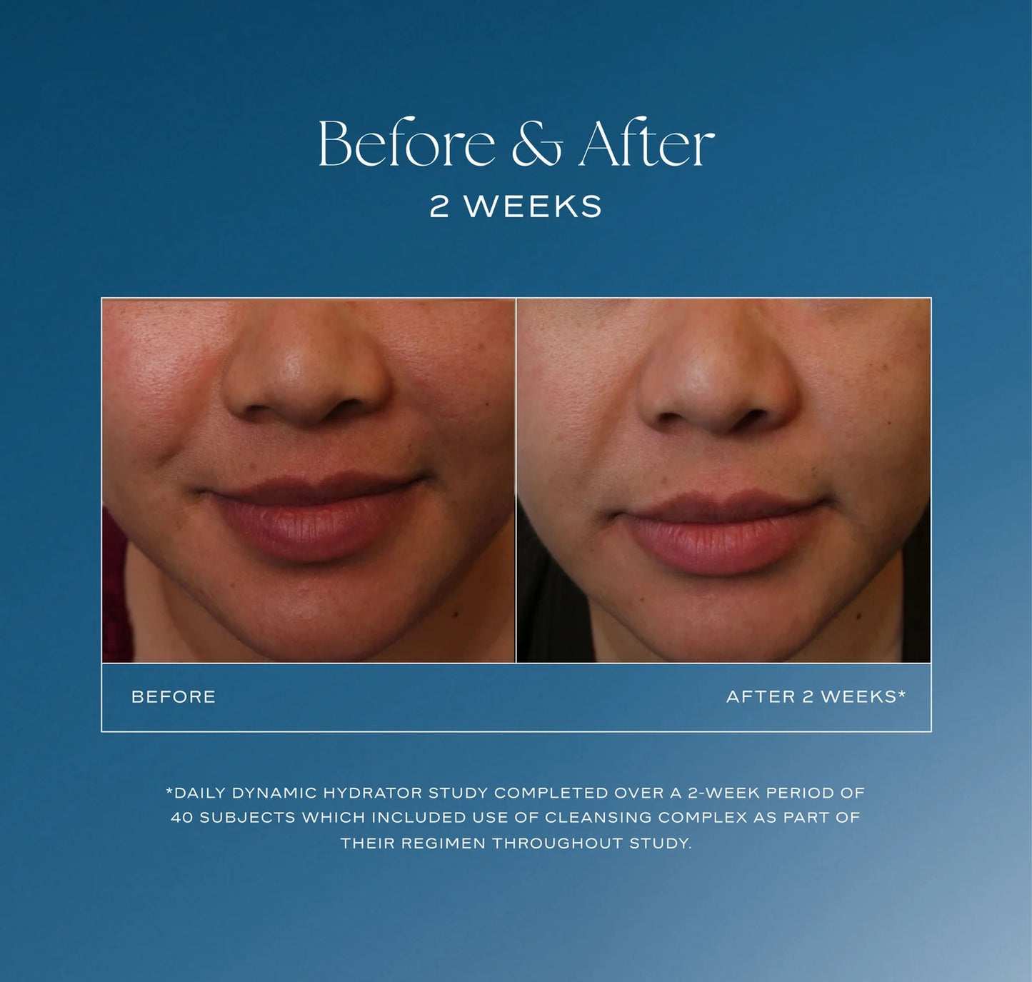 iS Clinical - Daily Dynamic Hydrator