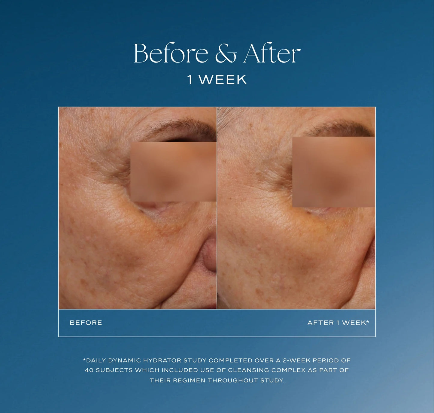 iS Clinical - Daily Dynamic Hydrator