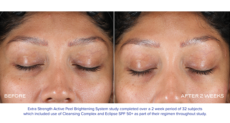 iS Clinical - Extra Strength Active Peel Brightening System