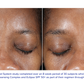 iS Clinical - Extra Strength Active Peel Brightening System