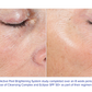 iS Clinical - Extra Strength Active Peel Brightening System