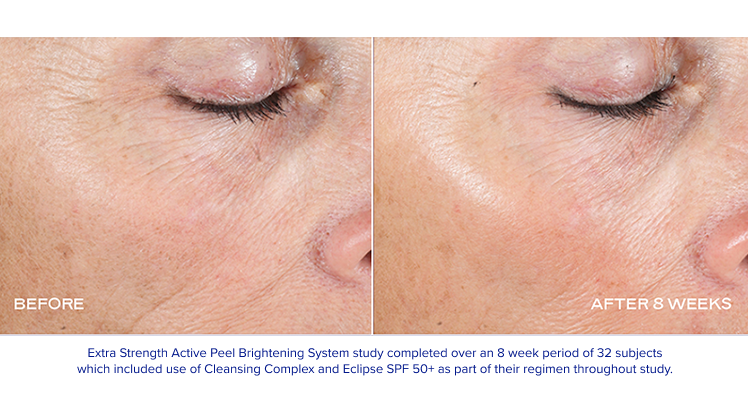 iS Clinical - Extra Strength Active Peel Brightening System